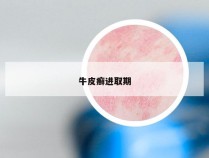 牛皮癣进取期