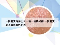 一到夏天身体上长一块一块的红癣 一到夏天身上就长红色的点