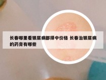 长春哪里看银屑病都择中价格 长春治银屑病的药膏有哪些