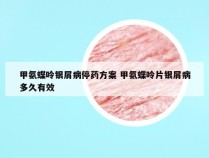 甲氨蝶呤银屑病停药方案 甲氨蝶呤片银屑病多久有效