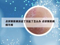 点状银屑病消退了又起了怎么办 点状银屑病痒不痒