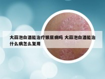 大蒜泡白酒能治疗银屑病吗 大蒜泡白酒能治什么病怎么复用