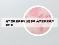 关节型银屑病平时注意事项 关节型银屑病严重后果