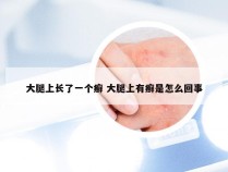 大腿上长了一个癣 大腿上有癣是怎么回事