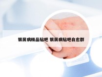银屑病精品贴吧 银屑病贴吧自愈群