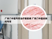广安门中医专家治疗银屑病 广安门中医皮肤科专家