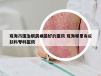 珠海市医治银屑病最好的医院 珠海哪里有皮肤科专科医院