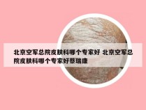 北京空军总院皮肤科哪个专家好 北京空军总院皮肤科哪个专家好蔡瑞康