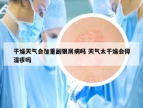 干燥天气会加重副银屑病吗 天气太干燥会得湿疹吗
