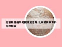 北京银屑病研究院康复总院 北京银屑病专科医院排名