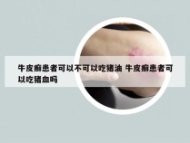 牛皮癣患者可以不可以吃猪油 牛皮癣患者可以吃猪血吗
