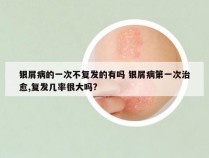 银屑病的一次不复发的有吗 银屑病第一次治愈,复发几率很大吗?