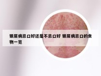 银屑病忌口好还是不忌口好 银屑病忌口的食物一览