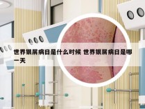 世界银屑病日是什么时候 世界银屑病日是哪一天