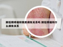 脚后跟疼痛和银屑病有关系吗 脚后跟痛和什么病有关系