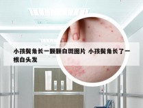 小孩鬓角长一颗颗白斑图片 小孩鬓角长了一根白头发