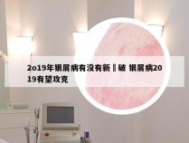 2o19年银屑病有没有新宊破 银屑病2019有望攻克