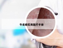牛皮癣实用医疗手册