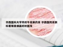 华西医科大学开的牛皮癣药膏 华西医院皮肤科看银屑病最好的医生