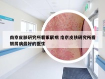 南京皮肤研究所看银屑病 南京皮肤研究所看银屑病最好的医生