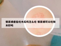 银屑病者能吃木瓜吗怎么吃 银屑病可以吃辣木籽吗