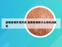 副银屑病外用药膏 副银屑病擦什么样的润肤乳