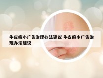 牛皮癣小广告治理办法建议 牛皮癣小广告治理办法建议
