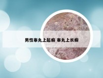 男性睾丸上起癣 睾丸上长癣