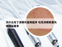 为什么吃了消银片越用越多 吃完消银胶囊为啥越起越多