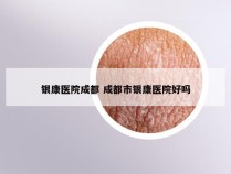 银康医院成都 成都市银康医院好吗