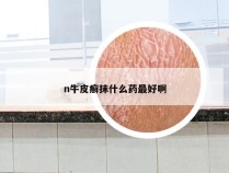 n牛皮癣抹什么药最好啊