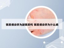 银屑病会转为副银屑吗 银屑病会转为什么病