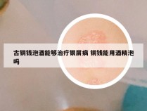 古铜钱泡酒能够治疗银屑病 铜钱能用酒精泡吗