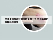 兰州皮肤科最好的医院是哪一个 兰州最好的皮肤科是哪家