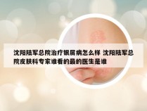 沈阳陆军总院治疗银屑病怎么样 沈阳陆军总院皮肤科专家谁看的最的医生是谁
