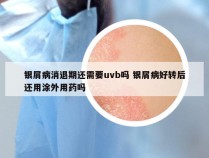 银屑病消退期还需要uvb吗 银屑病好转后还用涂外用药吗