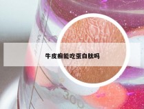 牛皮癣能吃蛋白肽吗