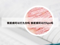 银屑病可以打九价吗 银屑病可以打hpv吗