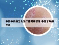 牛得牛皮癣怎么治疗能彻底根除 牛得了牛癣咋办