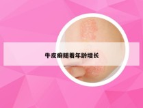 牛皮癣随着年龄增长