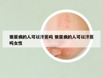 银屑病的人可以汗蒸吗 银屑病的人可以汗蒸吗女性