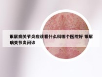 银屑病关节炎应该看什么科哪个医院好 银屑病关节炎问诊