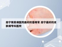 南宁银屑病医院最好的是哪家 南宁最好的皮肤病专科医院