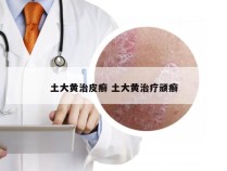 土大黄治皮癣 土大黄治疗顽癣