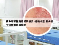 新乡哪家医院看银屑病去z选杨淑莲 新乡哪个诊所看银屑病好