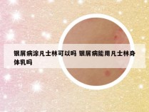 银屑病涂凡士林可以吗 银屑病能用凡士林身体乳吗