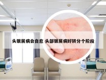 头银屑病会自愈 头部银屑病好转分个阶段