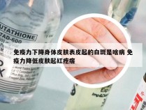 免疫力下降身体皮肤表皮起的白斑是啥病 免疫力降低皮肤起红疙瘩