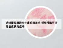 透明质酸原液对牛皮癣管用吗 透明质酸可以修复皮肤炎症吗