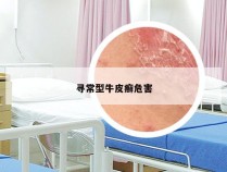 寻常型牛皮癣危害